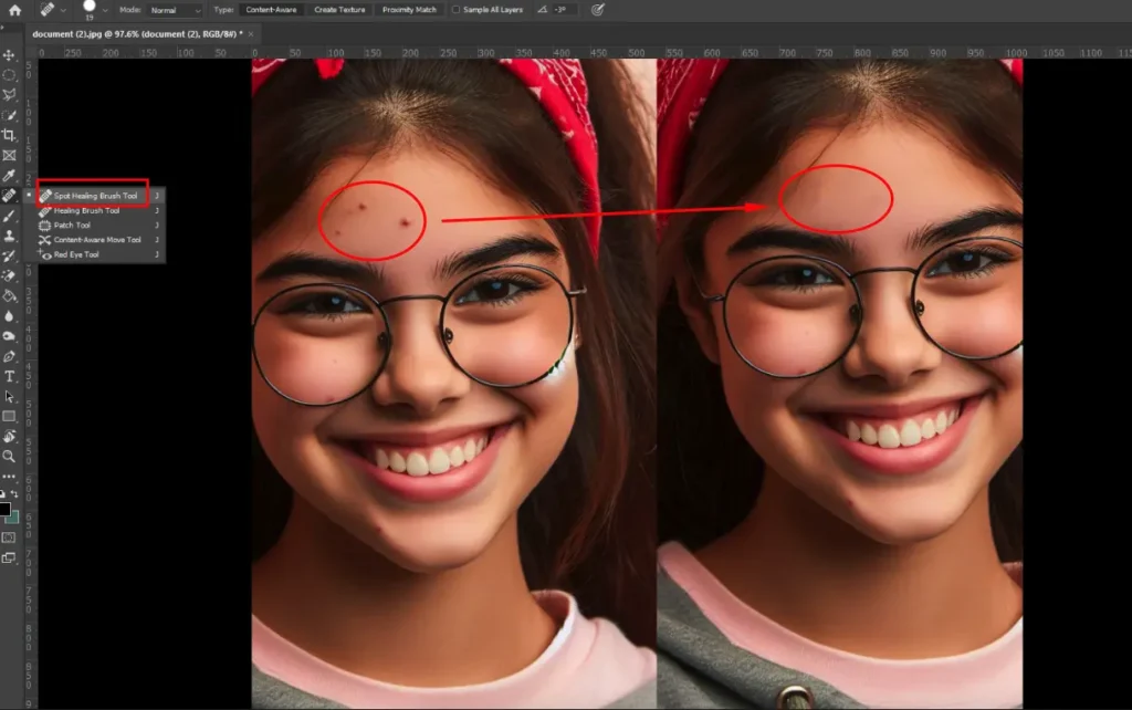 A comparison image showing the use of the Spot Healing Brush Tool in Photoshop to remove acne from a young girl's forehead. The left side shows the original skin with acne, and the right side displays the smooth, retouched skin.