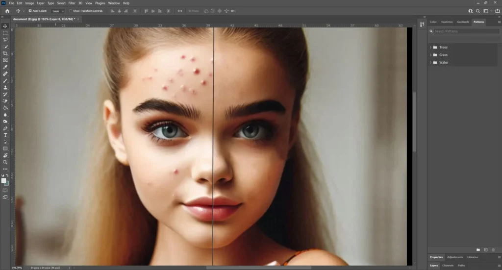 A comparison image showing skin smoothing in Photoshop. The left side of the face displays acne and blemishes, while the right side showcases a smooth, flawless complexion.