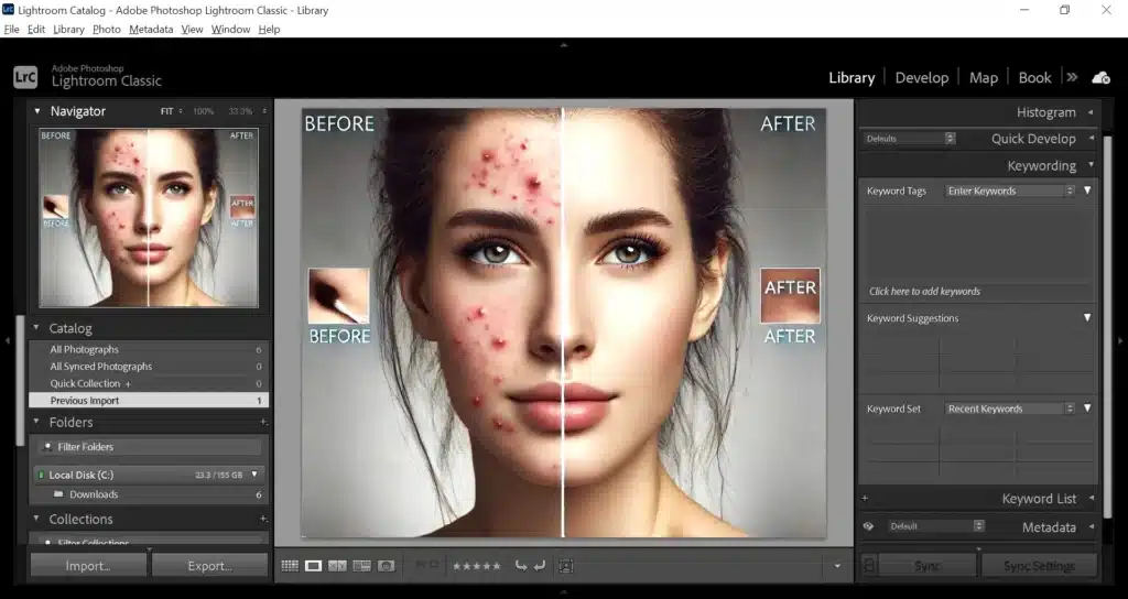 Screenshot of Adobe Lightroom showing a before-and-after comparison of a woman's face, with acne removed using the Patch Tool in Lightroom. The 'Before' side displays acne, while the 'After' side shows clear skin by using the Lightroom Patch Tool.